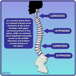 Nerve Tension and Scoliosis - Scoliosis Care Centers