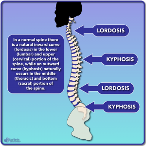 Example of normal lordosis and kyphosis curves in the spine