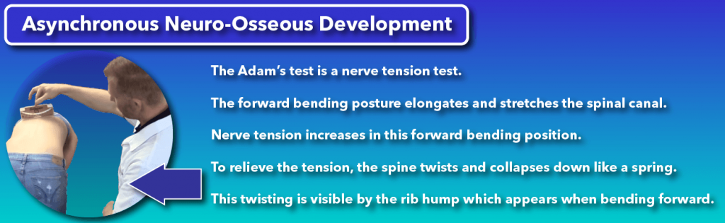 The Adam's forward bending test for scoliosis assesses nerve tension