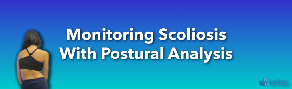 Postural analysis use to monitor scoliosis