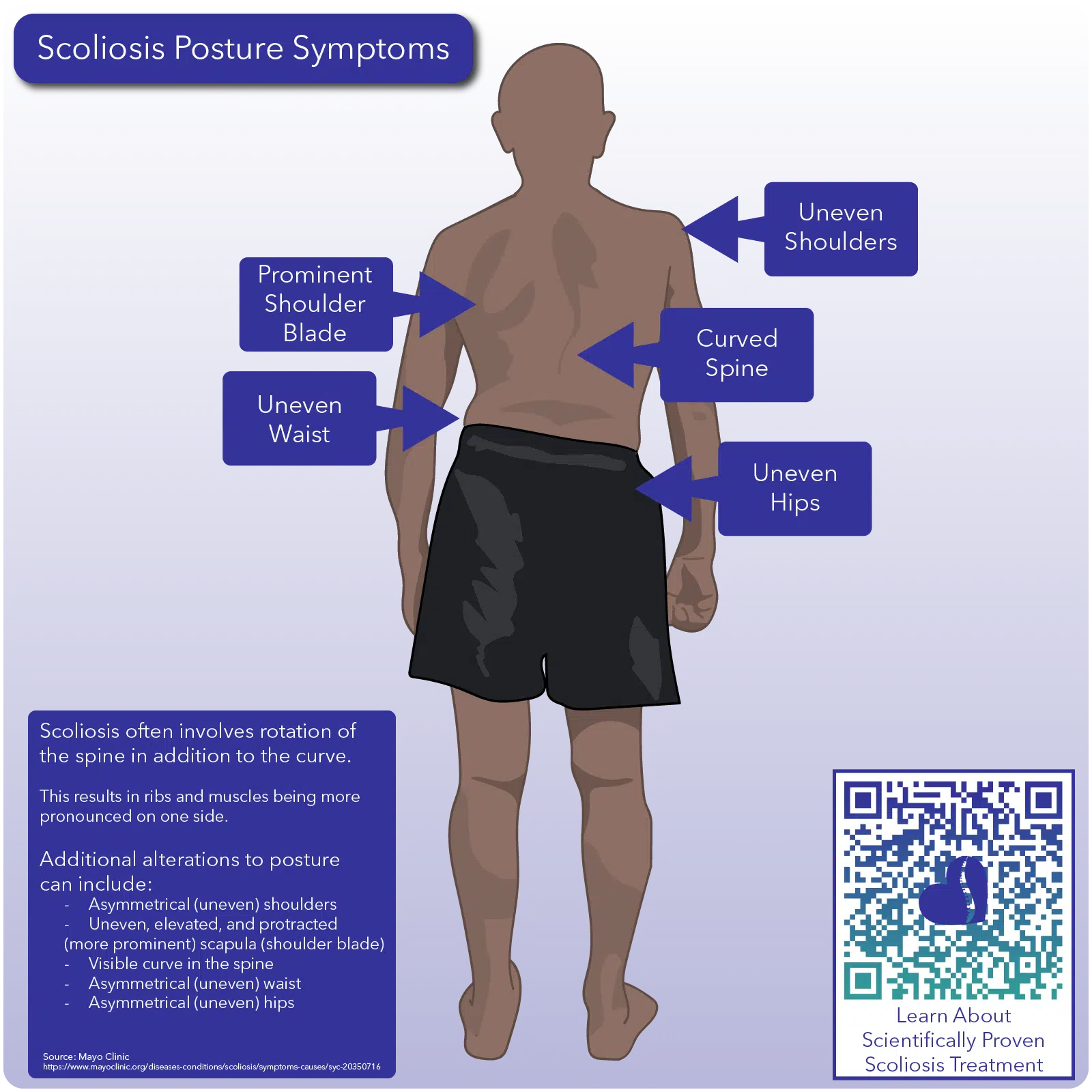 Scoliosis Posture Results - Scoliosis Care Centers