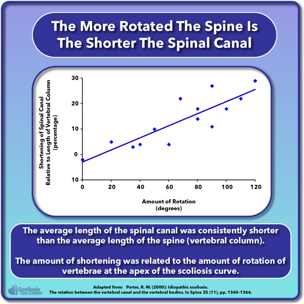 Why Does Scoliosis Get Worse With Growth? Scoliosis Care Centers