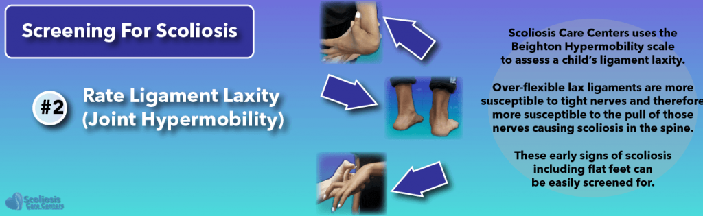 Screening for hypermobility and flat feet can aid in nerve tension and scoliosis detection