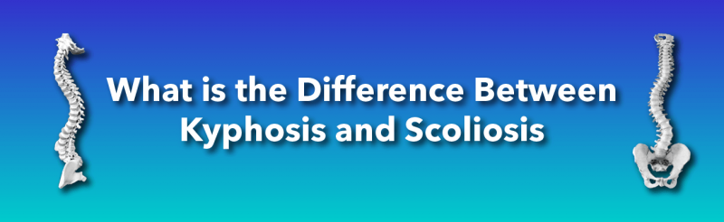 What is the Difference Between Scheuermann’s Hyperkyphosis and Scoliosis