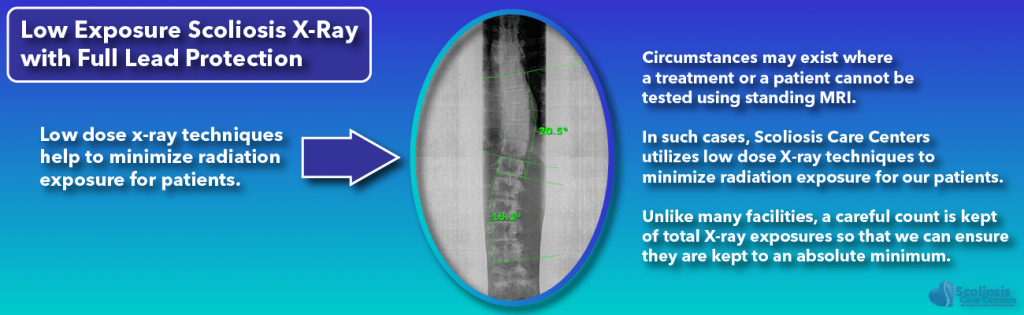 low exposure scoliosis xray with full lead protection