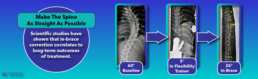 Non-Surgical Scoliosis Improvement: Straighten the Spine