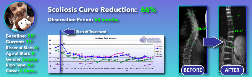 66 percent scoliosis reduction achieved through non-surgical methods