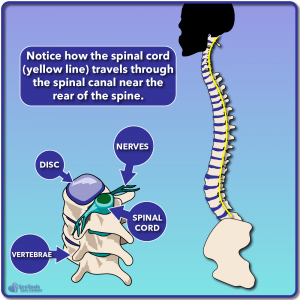 Cross section diagram of spinal cord and spinal canal