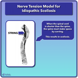 Roth spring model for scoliosis nerve tension
