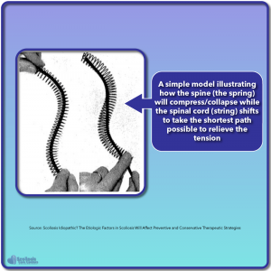 Spring model of nerve tension causing scoliosis as described by Dr. Roth