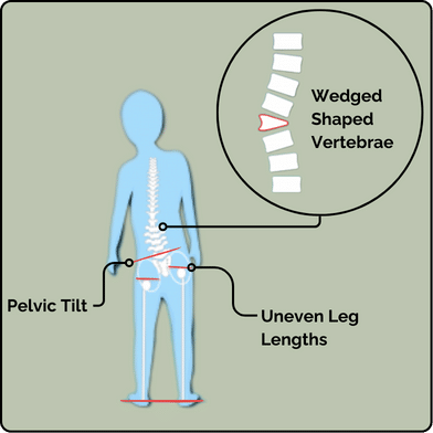 Structural Asymmetry Graphic