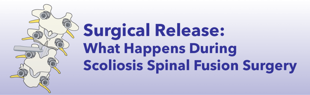 Surgical Release - What Happens During Scoliosis Spinal Fusion Surgery