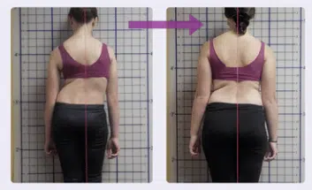 Posture transformation before and after