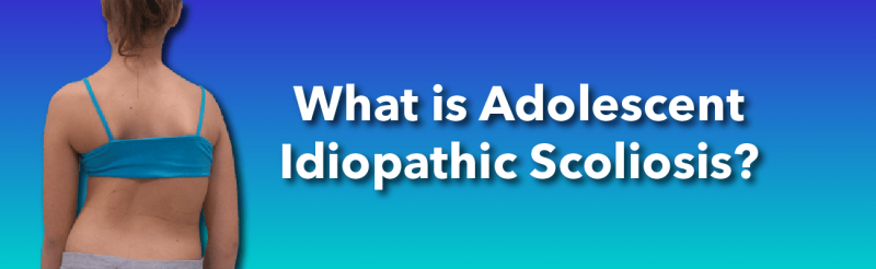 What is Adolescent  Idiopathic Scoliosis?