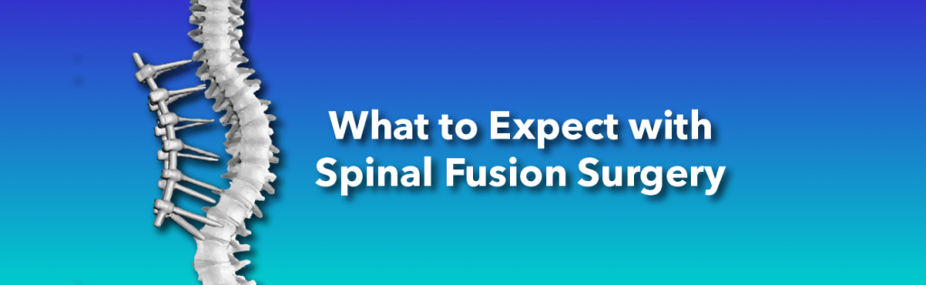 spinal-fusion-surgery-for-scoliosis-what-it-is-and-what-to-expect