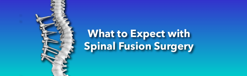 Scoliosis Spinal Fusion Surgery: What to expect