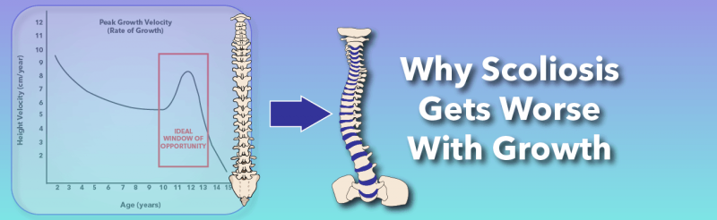 Why Does Scoliosis Get Worse With Growth?